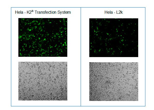 Microscopy after transfection of HeLa cells with K2® Transfection System and L2k