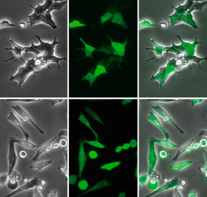 High-resolution images of transfection of HeLa cells with pCMV-GFP using μ-Transfection Kit VI
